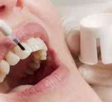 Obnova zobnega emajla: metode restavriranja zobne sklenine