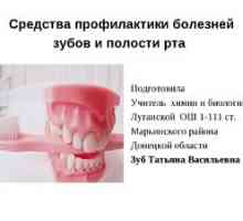 Bolezni ustne votline: hude bolezni in preprečevanje