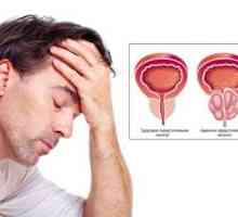 Bolezni prostate: simptomi