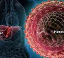 Je zlatenica virusa kakšnega hepatitisa?