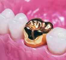 Zlati zobje - kakovostno zobozdravstvo ali maveton?