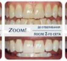 Zoom 4 - nova in varna beljenje zob