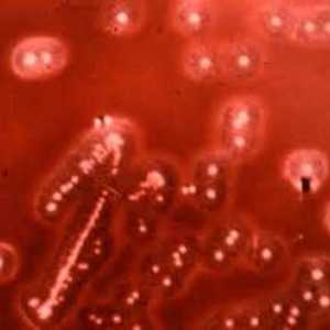 Bakterije streptococcus viridans (streptococcus viridans)