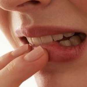 Žvečilni gumi je boleč na koncu spodnje čeljusti