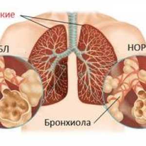Kaj je to? - Obstrukcija pljuč: klasifikacija in zdravljenje