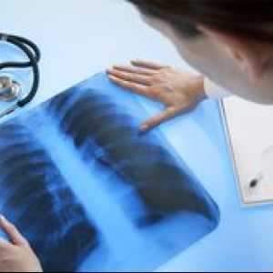 Kakšno je izboljšanje pljučnega vzorca na rentgenskem slikanju?