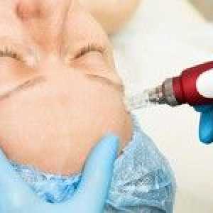 Delna mezoterapija in njena učinkovitost za kožo obraza