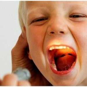 Purulent pluta v grlu: simptomi in zdravljenje