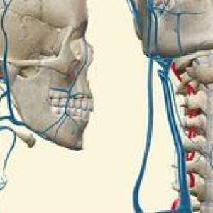 Glavoboli z osteohondrozo materničnega oddelka