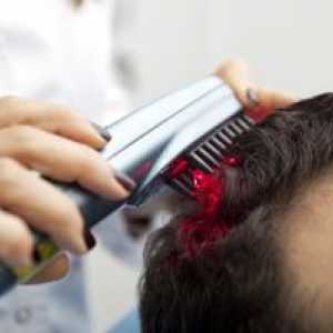 Značilnosti laserskih glavnikov proti izpadanju las