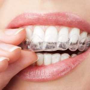 Kako pravilno uravnavati in zravnati zobe doma