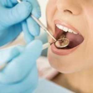 Kako zapolniti zobe, kakšen je postopek zobnega polnila