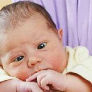 Kdaj se pri novorojenčkih pojavijo strabizem?
