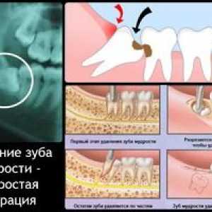 Kdaj rastejo zobje zob in koliko rastejo?
