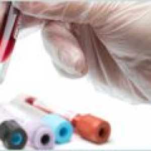 Kvantitativni test za tuberkulozo v in vitro
