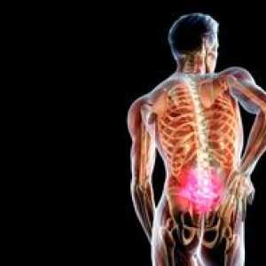 Zdravljenje hrbtenice kirurgov brez kirurškega posega