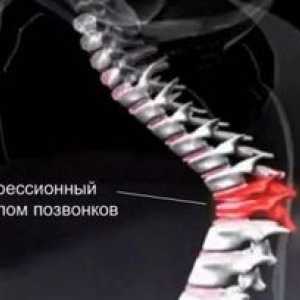 Zdravljenje starejših z zlomom hrbtenice zaradi kompresije