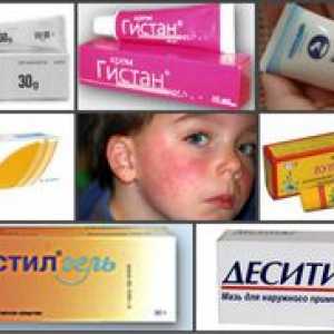 Mast za kožne alergije za odrasle in otroke