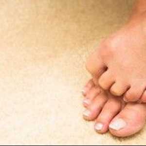 Na nogi boli palec: vzroki za bolezen