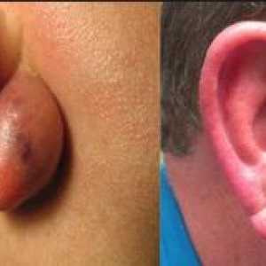 Kaj naredi komoro na uho v ušesu?