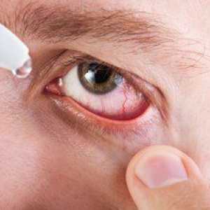 Redednost oči in vnetja: vzroki in simptomi, zdravljenje