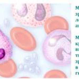 Povečano število monocitov v krvi