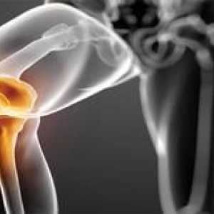 Bolezni sklepa kolenskega sklepa: diagnoza in zdravljenje