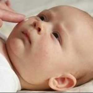 Kaj morate vedeti o strupeni eritem pri novorojenčkih