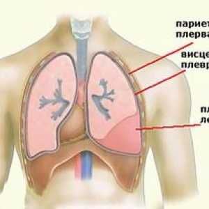 Kaj je navedeno v pljučnih pljučnih plasti pri fluorografiji