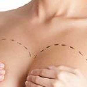 Kaj je mamoplastika: metode protetike?