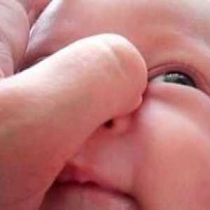 Dakriocistitis pri novorojenčkih, simptomi in zdravljenje