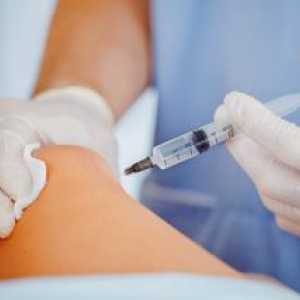 Hialuronska kislina: lastnosti, injekcije v kolenskem sklepu, cena