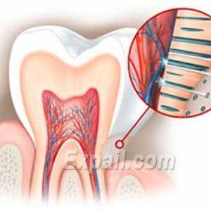 Hiperestezija zobnega emajla: vzroki, simptomi in zdravljenje