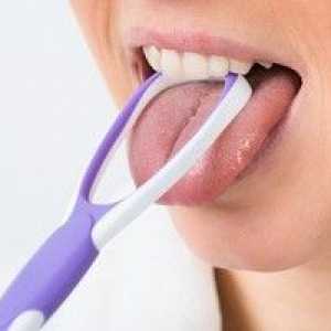 Kako očistiti jezik in odstraniti plaketo: načine za čiščenje