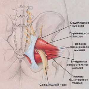 Kako in kje lahko odstranite krče mišic v obliki hrušk?