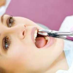 Kako prenehati krv po ekstrakciji zoba