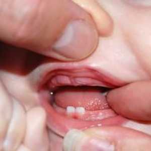 Kako otroci rastejo zobe: red in doslednost