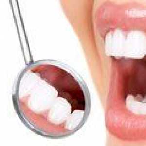 Kako odstraniti zob v zobozdravstvu in doma?