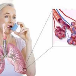 Kako pozdraviti astmo: se lahko znebim za vedno doma