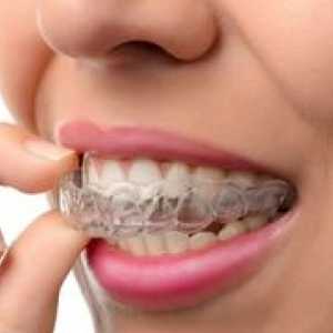 Kako uskladiti zobe brez svitkov: učinkovite metode