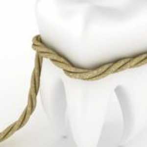 Katere so lahko zaplete po ekstrakciji zob?