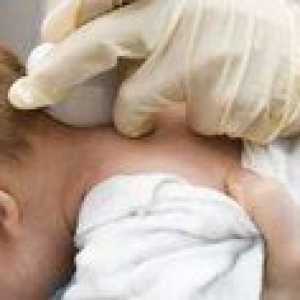 Cista v glavi pri novorojenčkih: vzroki in posledice