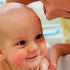 Zdravljenje atopičnega dermatitisa pri otrocih
