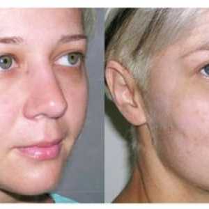 Dvižna krema - najboljši pripomoček za kožo obraza z učinkom zavor