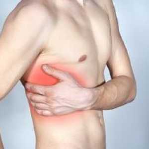 Medkostna nevralgija prsnega koša: simptomi in zdravljenje
