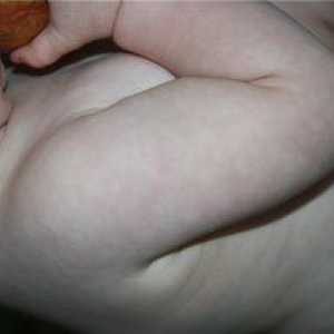 Mramorna koža pri dojenčkih: vzroki in metode zdravljenja