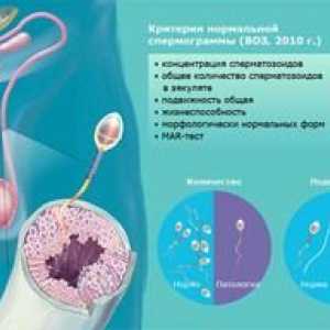 Norme za analizo spermograma pri moških in vzroke za nenormalnosti