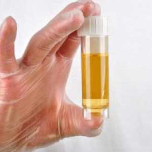 Kaj beljakovin pove otroku z urinom?