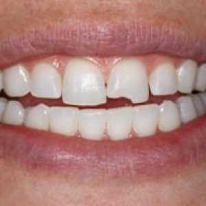 Glavni razlogi za zrušenje zob