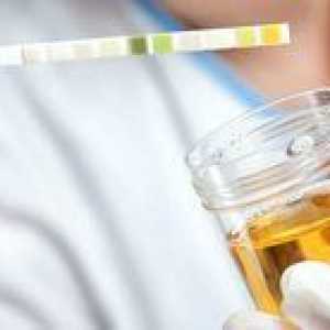 Glavni razlogi za nastanek motnega urin pri otroku